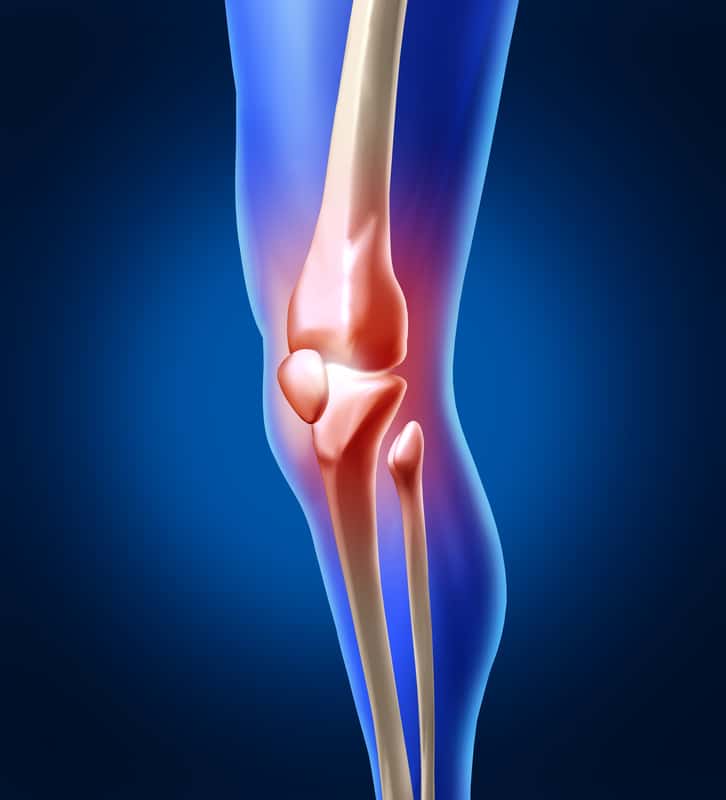 Human Knee Pain