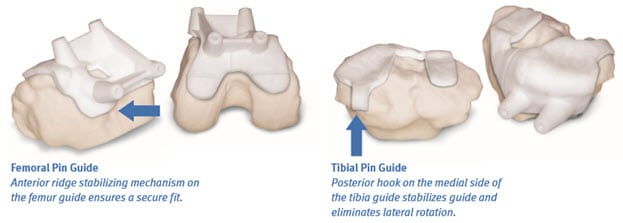 Guía de clavijas femorales y tibiales