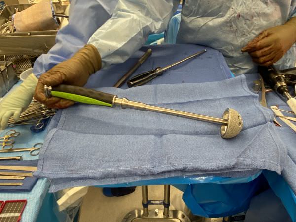 Cup hip replacement 