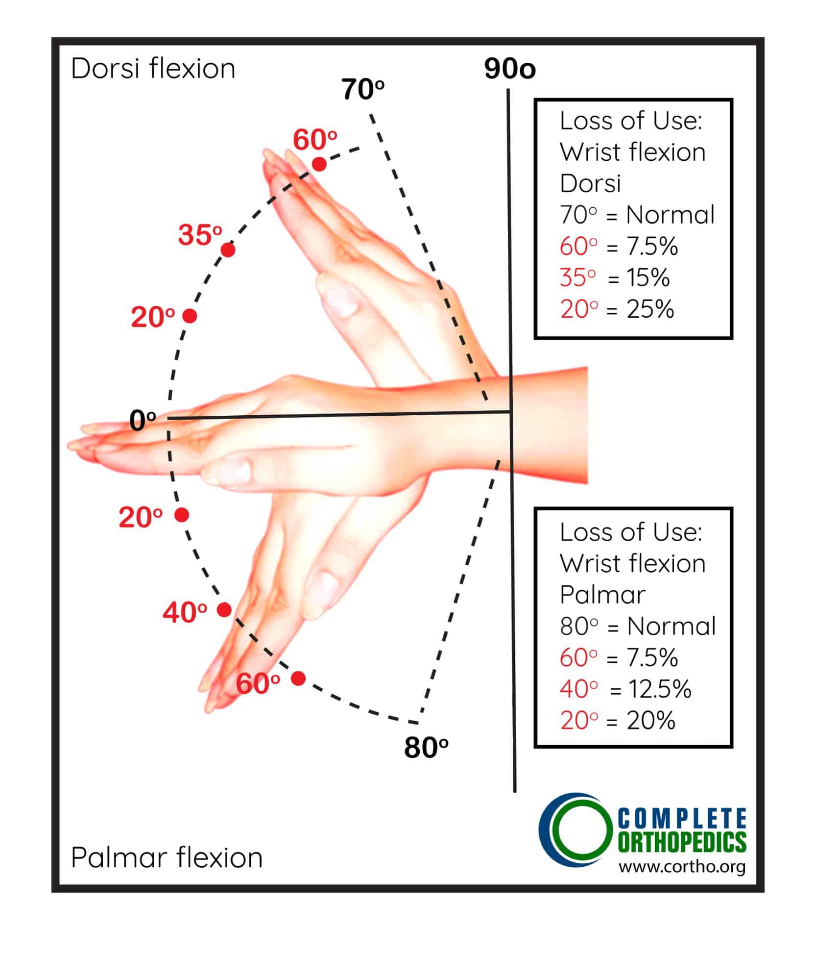 Figura: Flexión dorsal y flexión palmar de la muñeca: Determinación del porcentaje de pérdida de uso de la mano