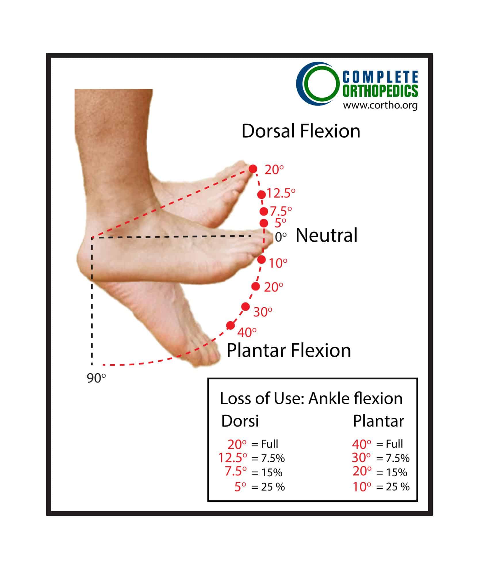 Figure : Pourcentage de perte d'usage du pied : Déficits de flexion de la cheville