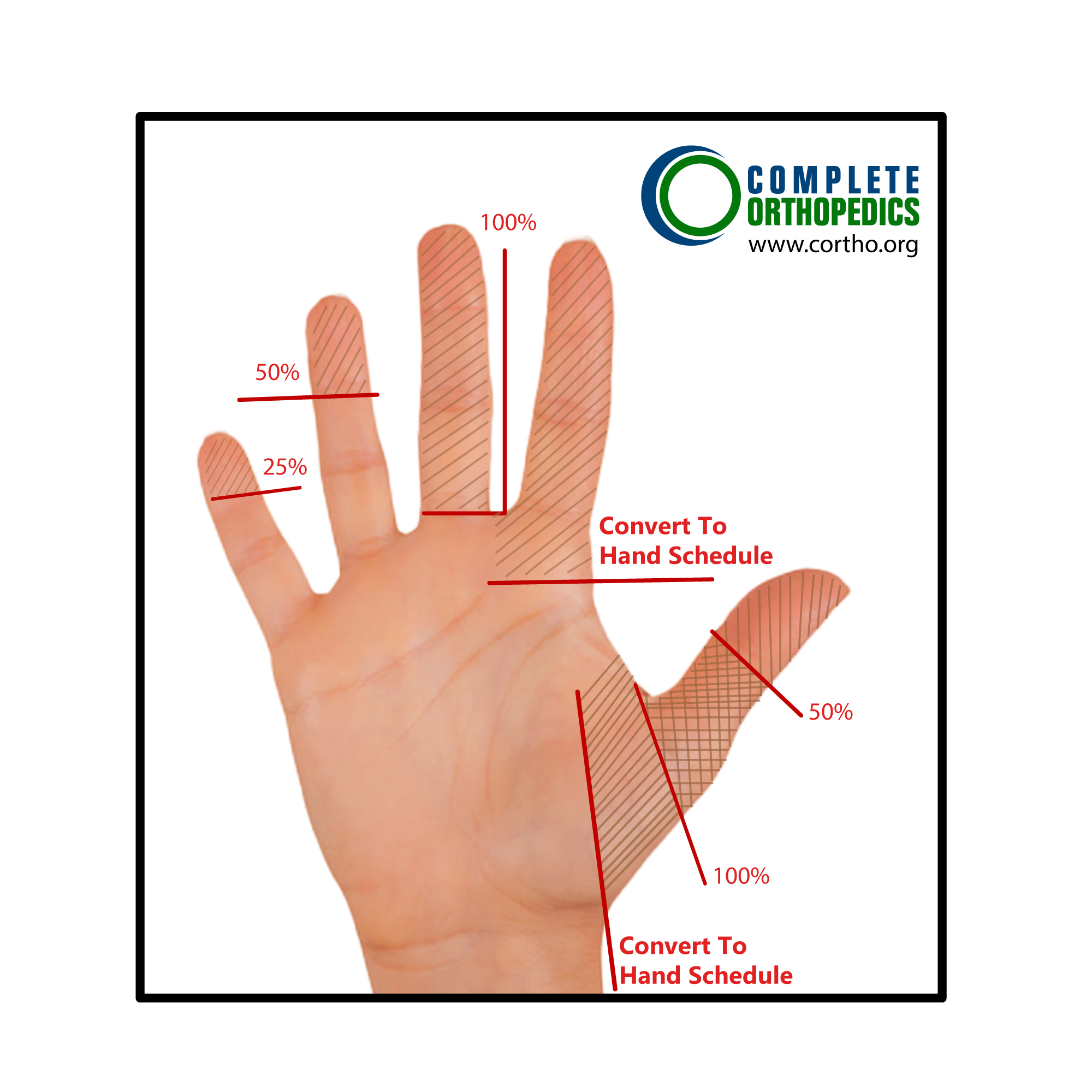 Figure: Amputation Schedule Loss of Use of the Fingers